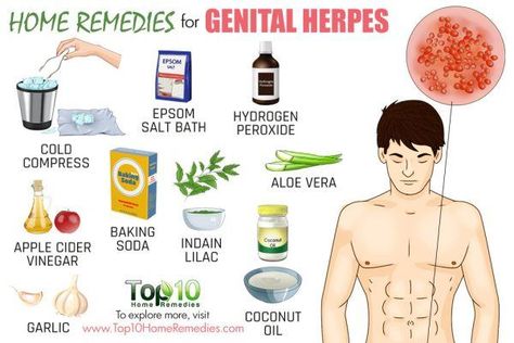 home remedies for genital warts Warts On Face, Home Remedies For Warts, Warts Remedy, Toenail Fungus Remedies, Top 10 Home Remedies, Healing Touch, Toenail Fungus, Skin Remedies, Skin Care Remedies