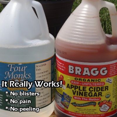 Uses For Vinegar, Heal Sunburn, Vinegar Uses, Magic Garden, Veggie Garden, Cider Vinegar, Lawn And Garden, Apple Cider Vinegar, Permaculture