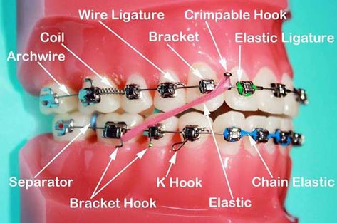 Orthodontist Assistant, Time Diagram, Ceramic Braces, Dental Assistant Study, Dentist Assistant, Dental Hygiene Student, Braces Tips, Kedokteran Gigi, Dental Hygiene School