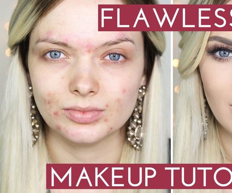 Makeup Tutorial - How To Apply HD Foundation Acne Coverage Makeup, Flawless Makeup Tutorial, Acne Coverage, Flawless Face Makeup, Makeup Cantik, Acne Makeup, Foundation Routine, Best Makeup Tutorials, Makeup Tutorial Foundation