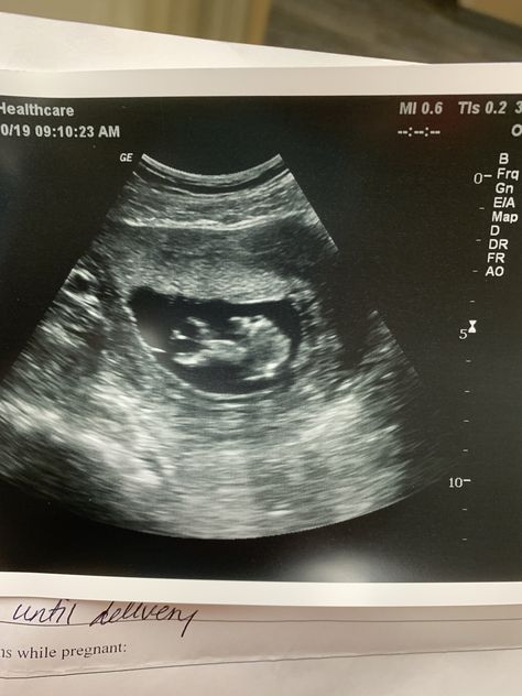 1st ultrasound of baby girl! Ultrasound Pictures 1 Month, 3 Month Ultrasound Pictures, Ultrasound Pictures 2023, Fake Ultrasound Pictures 4 Weeks, Fake Ultrasound Pictures 2023, First Ultrasound Picture Ideas, 3 Month Ultrasound, Fake Ultrasound Pictures, 5 Week Ultrasound Pictures