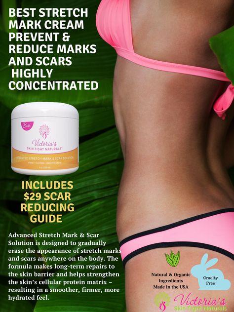 Strech Marks, Stretch Mark Remedies, Marks Cream, Scar Cream, Stretch Mark Removal, Stretch Mark Cream, Stretch Mark, Saggy Skin, Skin Essentials