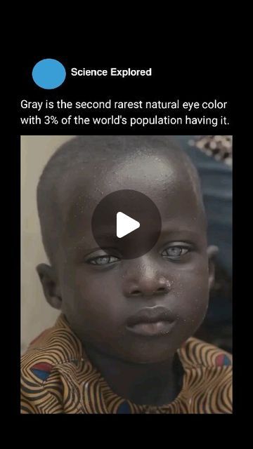 Rarest Eye Color, Tyndall Effect, Biology Genetics, Rare Eye Colors, Green Science, Science Knowledge, Rare Eyes, Gray Eyes, Natural Eyes