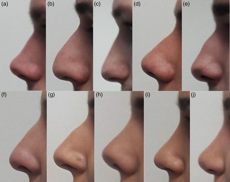 985231160371193-pin-image Profile views of ten different human noses showcasing variations in shape and size. Images labeled (a) to (j). | Sky Rye Design Nose Anatomy, Nose Types, Parts Of The Nose, Types Of Facials, The Light Is Coming, Holistic Diet, Nose Drawing, Nose Shapes, Art Study