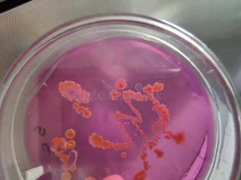 Staphylocccus aureus bacterial culture. The Staphylococcus aueus bacteria grown #Sponsored , #paid, #ad, #aureus, #culture, #bacteria, #bacterial Bacterial Culture, Microbiology Laboratory, Petri Dish, Microbiology, Photo Image, Stock Photos