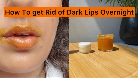 Lip Hyperpigmentation, Hyperpigmentation Mask, Remedies For Dark Lips, Lip Pigmentation, Lighten Dark Lips, Aloe Vera For Sunburn, Lip Lightening, Natural Remedies For Migraines, Pimples On Face