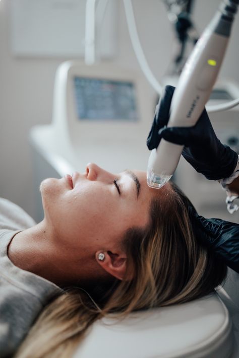 RF microneedling (virtue RF) Rf Microneedling, Medical Aesthetician, Esthetician Marketing, Facial Aesthetics, Laser Clinics, Aesthetic Clinic, Beauty Clinic, Skin Clinic, Medical Spa