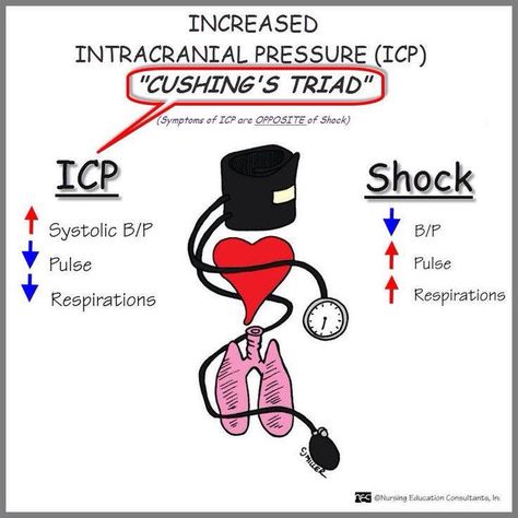 Cushing's Triad: wide pulse pressure, bradycardia, htn Nursing Education Consultants Cartoons, Emt Instructor, Cushing Triad, Future Lpn, Neuro Nursing, Medical Diseases, Nursing Apps, Emt Study, Paramedic Student