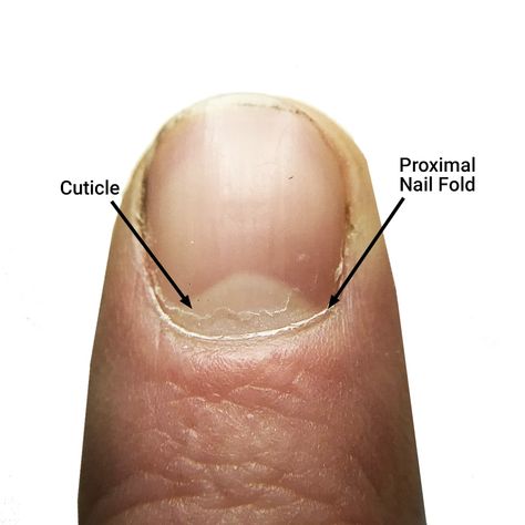 Nail Structure, Cuticle Care, Cuticle Remover, Nail Care Routine, Nail Care Tips, Brittle Nails, Nail Growth, Nail Cuticle, How To Grow Nails