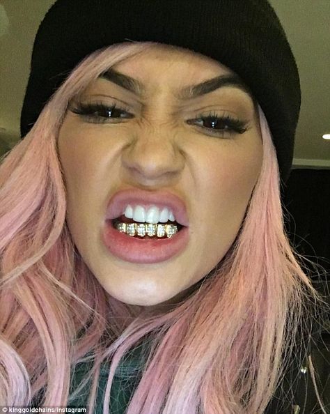 Diamonds are forever: Kylie Jenner showed off a new diamond-encrusted grill in Tyga's Instagram photo on Monday Kylie Jenner Pink Hair, Girls With Grills, Girl Grillz, Kylie Jenner Icons, King Kylie Era, Grillz Teeth, Diamond Grillz, Gold Grill, 3 Strikes