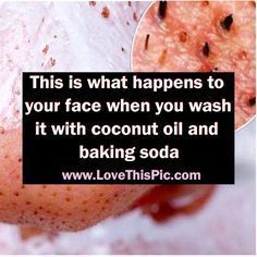 If You Wash Your Face With Coconut Oil And Baking Soda THIS Is What Happens To Your Face... Coconut Oil And Baking Soda, Health Coconut Oil, Baking Soda Face, Baking Soda Benefits, Coconut Oil Skin Care, Coconut Oil For Face, Coconut Oil Uses, Coconut Oil For Skin, Oil Uses