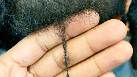 be a genetic scalp disorder that can be Loc Brushing, Thinning Locs, Thick Locs, Two Strand Twists, Hair Care Regimen, Starter Locs, Big Curls, Itchy Scalp, Scalp Conditions