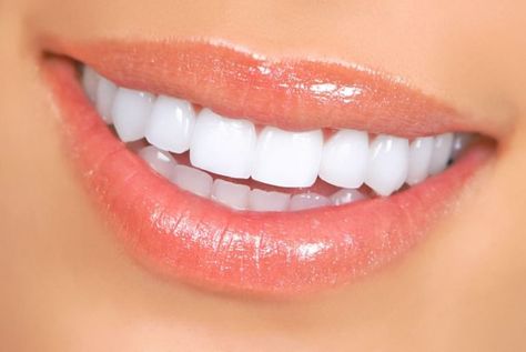 Natural Teeth Whitening Diy, Snap On Smile, Kedokteran Gigi, Veneers Teeth, Teeth Whitening Remedies, Beautiful Teeth, Teeth Whitening Diy, Straight Teeth, Perfect Teeth