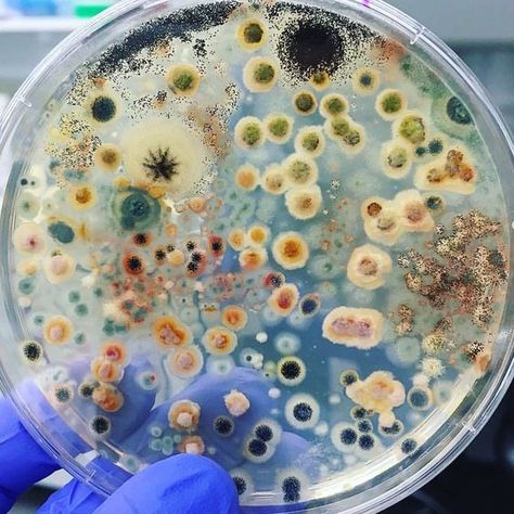 Epidemiology Aesthetic, Neurosurgeon Aesthetic, Happy Future, Science Girl, Microscopic Photography, Growth And Decay, Petri Dishes, Biology Art, Bio Art