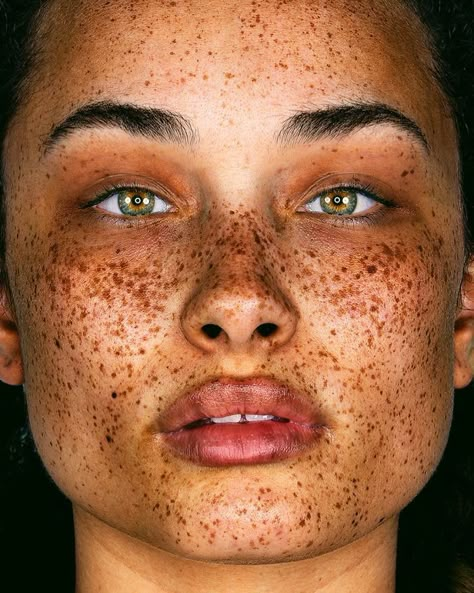 Photographer Takes Portraits Of Freckled People To Celebrate Their Unique Beauty Brock Elbank, Redhead With Freckles, Cute Freckles, People With Freckles, Lemon Face Mask, Women With Freckles, Faux Freckles, Beautiful Freckles, Beauty Marks