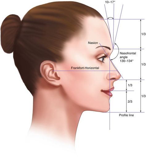 Facial Evaluation in Orthognathic Surgery | SpringerLink Orthognathic Surgery Before And After, Blephoraplasty Surgery, Surgery Nose, Nose Surgery Rhinoplasty, Orthognathic Surgery, Rhinoplasty Nose Jobs, Face Proportions, Facial Anatomy, Pretty Nose