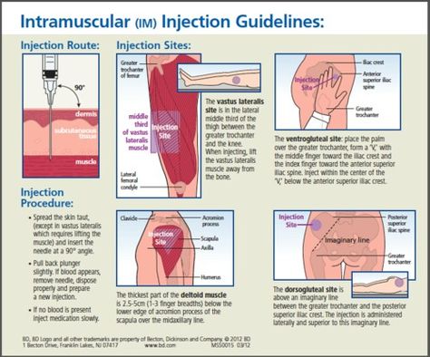 Intramuscular injection guidelines Nursing Surgery, Intramuscular Injection Sites, Im Injection Sites, Injection Sites, Im Injection, Triage Nursing, Medical Terminology Study, Nursing Study Tips, Medical Assistant Student