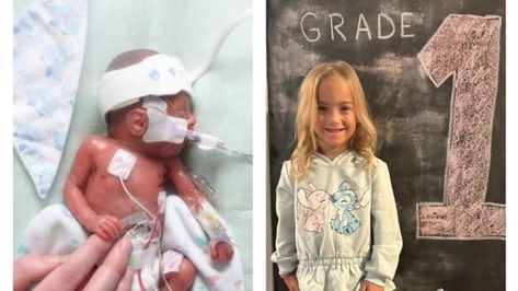 She weighed less than 500 grams at birth. This P.E.I. micro-preemie is now 6 and thriving | CBC News Grown Ups 1, Look At Her Now, Micro Preemie, Prince Edward Island, Prince Edward, Grade 1, How To Be Outgoing, Growing Up, Prince