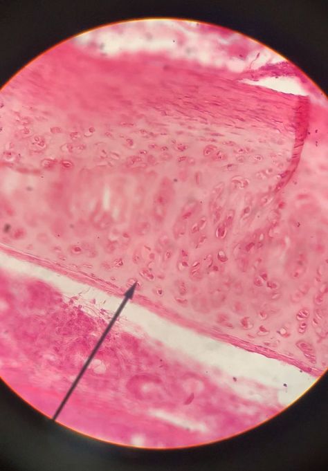 Hyaline Cartilage, Connective Tissue, The Nose, Anatomy And Physiology, Academia Aesthetic, Anatomy, Elastic, Glass, Quick Saves