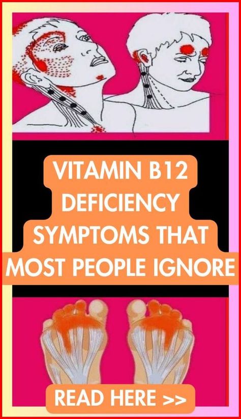 VITAMIN B12 DEFICIENCY SYMPTOMS THAT MOST PEOPLE IGNORE Vitamin B12 Deficiency Symptoms, Low Vitamin B12, Vitamin Deficiency Symptoms, Vitamin B12 Injections, B12 Deficiency Symptoms, Vit B12, B12 Injections, Deficiency Symptoms, Vitamin B12 Deficiency