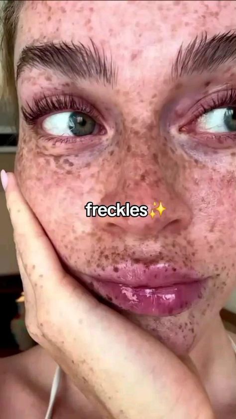 Girls with freckles are the prettiest🌸✨️💫🤧 
#freckles #prettygirls #aesthetic #freckled #women Girls With Freckles, People With Freckles, Freckles Girl, Beautiful Creatures, Beauty Hacks, Pins