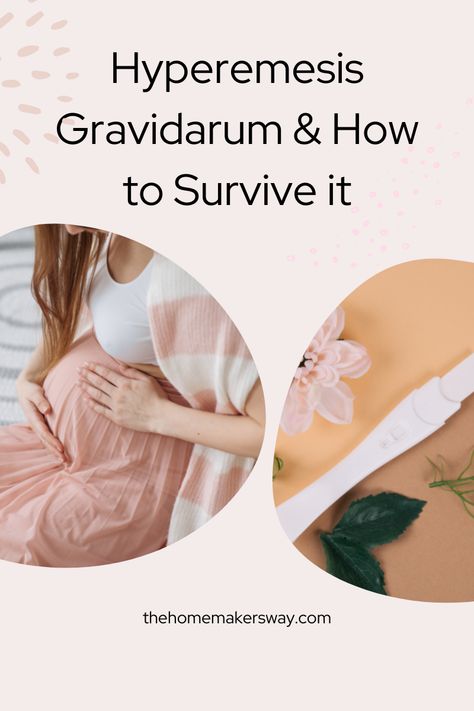 What it’s like to have hyperemesis gravidarum from a real mom of 2. Hyperemesis Gravidarum, Iv Fluids, Mom Of 2, Real Mom, Second Pregnancy, Doctor Office, Morning Sickness, How To Survive, First Pregnancy