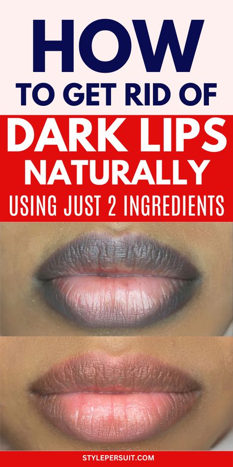 15 Best Home Remedies for Dark Lips – StylePersuit Lip Care Aesthetic, For Pink Lips, Glowing Makeup Look, Healthy Teeth Whitening, Remedies For Dark Lips, For Dark Lips, Skin Home Remedies, Bigger Hips Workout, Facial Care Routine