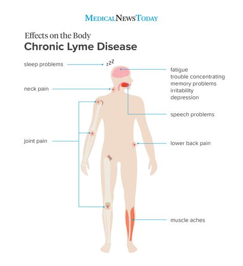 Lymes Disease, Body Rash, Endo Warrior, Chronic Lyme, Disease Symptoms, Memory Problems, Body Ache, Medical News, Sleep Problems