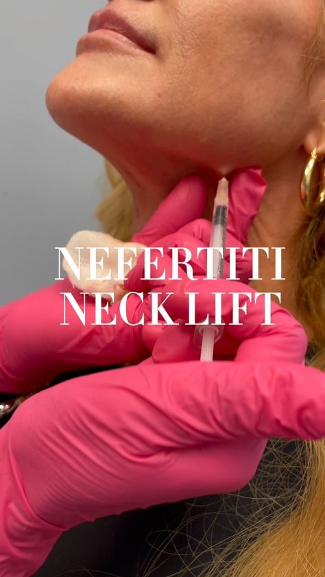 Dr. Kay Durairaj, MD, FACS | Have you heard of a Nefertiti Neck Lift? 🧐 Botox here improves the drape the skin and the jawline contour and provides the visual effect... | Instagram Botox In Neck, Botox Jawline Before And After, Platysmal Bands, Cheek Injections, Jawline Contour, Neck Lift Surgery, Cosmetic Injections, Saggy Neck, Manifest Board