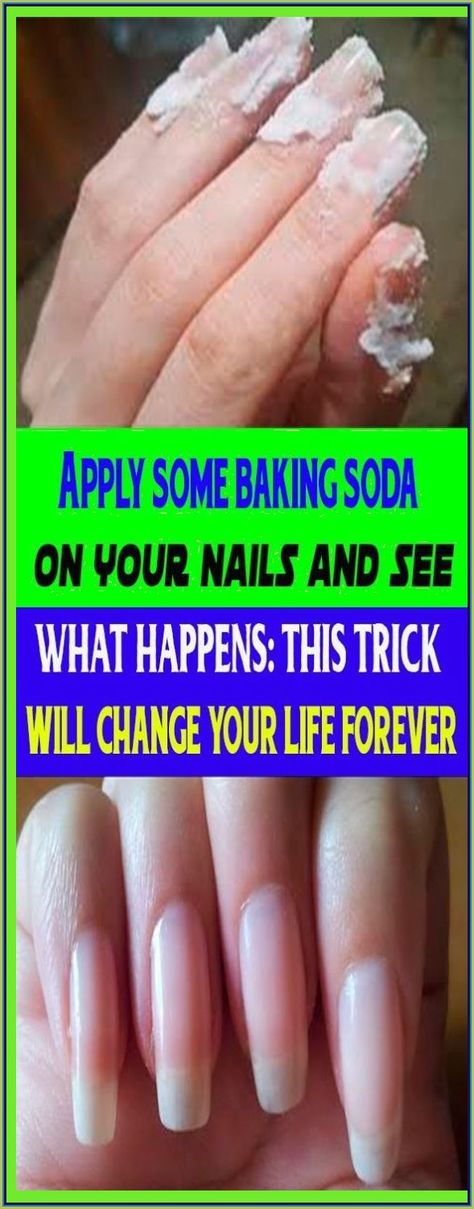 APPLY SOME BAKING SODA ON YOUR NAILS AND SEE WHAT HAPPENS: THIS TRICK WILL CHANGE YOUR LIFE FOREVER Soda Nails, Baking Soda Nails, Crystal Makeup, Cleaning Advice, Coconut Health Benefits, Baking Soda Shampoo, Face Wrinkles, Creating A Newsletter, When You Sleep