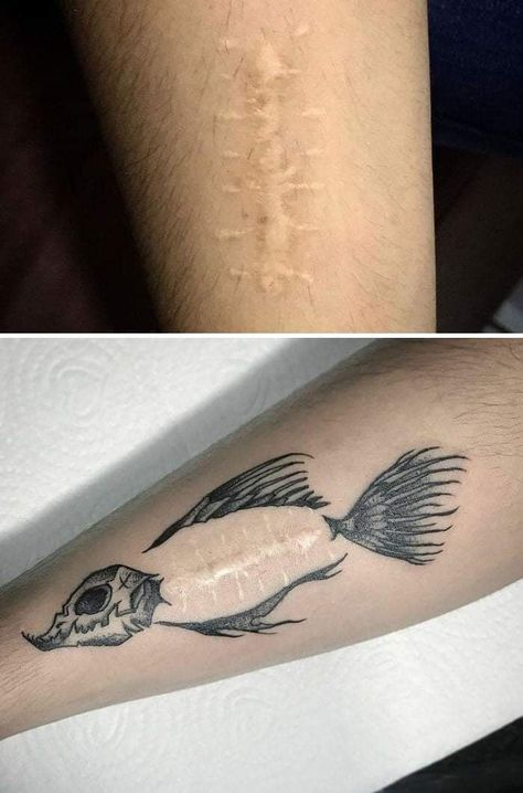 Tattoo ideas Tattoo Over Scar, Scar Cover Up, Tattoos To Cover Scars, Mark Tattoo, Scar Tattoo, Tatuaje A Color, Hand Tattoos For Guys, Tattoo Cover-up, Cover Up Tattoo