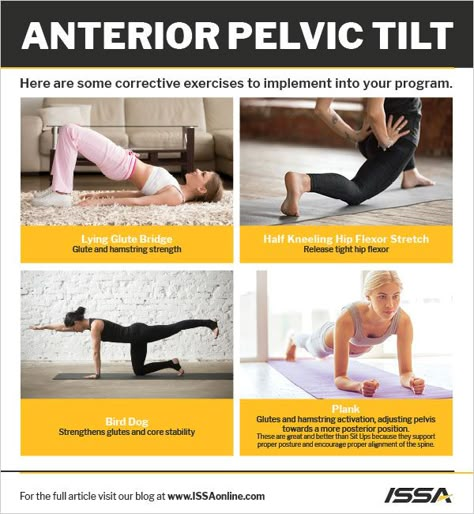 Pelvic Tilt: What Is It and How Do You Correct It? | ISSA Stretches For Anterior Pelvic Tilt, Pelvic Alignment Exercises, Pelvis Tilt Correction, Lumbar Lordosis Correction Exercise, Lordosis Correction Exercises, Anterior Pelvic Tilt Exercises, Lower Back Posture Correction, Anterior Pelvic Tilt Correction, Pelvic Tilt Correction