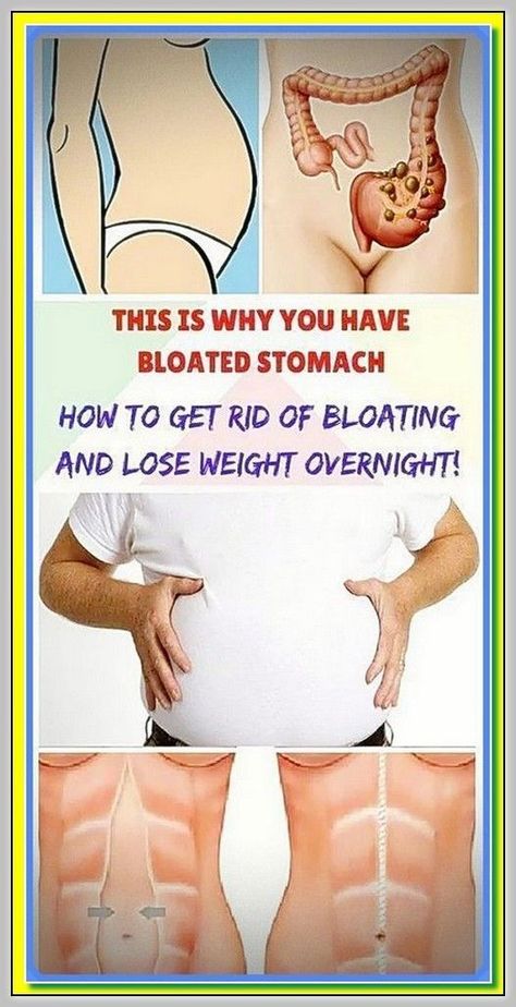 5 Unusual Causes of Bloated Belly and How to Beat It Bloated Stomach, Bloated Belly, How To Eat Less, Reduce Weight, Holistic Health, Womens Health, Belly Fat, Health Tips, Nutrition