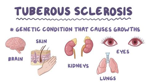 MEDICAL SCHOOL: Tuberous sclerosis,what to know? Tuberous Sclerosis, Case Presentation, Medical Anatomy, Coping Strategies, Medical Students, Medical School, Anatomy, Medicine, Presentation