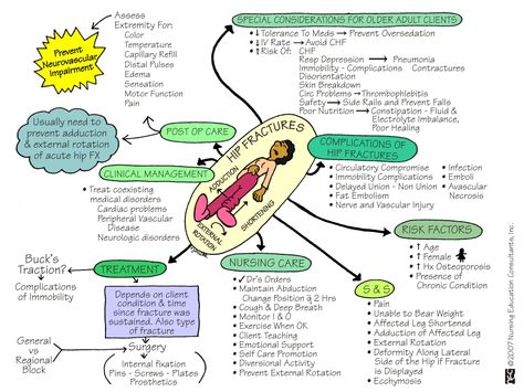 Hip Fracture - Nursing Care Ortho Neuro Nursing, Shock Nursing Notes, Orthopaedic Nursing, Nursing Neuro, Lvn School, Respiratory Medicine, Nursing Facts, Humerus Fracture, Peds Nursing