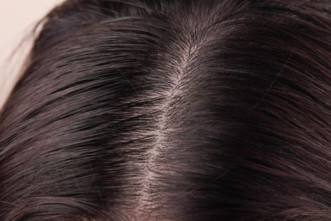 How to Clean Sebum From the Scalp Natural Hair Removal Remedies, Thick Hair Remedies, Clean Scalp, Oily Scalp, Coconut Oil Hair, Hair Control, Body Hair Removal, Grow Hair Faster, Scalp Health