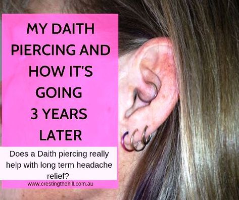 There's no scientific proof that a daith piercing works to relieve migraines and chronic headache. I've had mine for three years and this is how mine has impacted on my headaches. #daith #piercing #headaches #migraines Ear Piercing For Headaches, Ear Piercing For Migraines, Piercing For Migraine Relief, Daith Piercing Migraine, Migraine Piercing, Kylie Jenner Ear Piercings, Hormonal Headaches, Inner Ear Piercing, How To Relieve Migraines