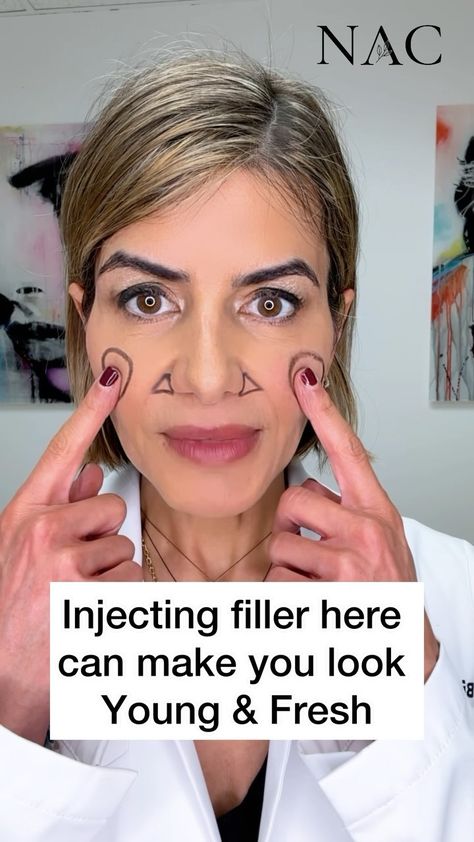 Botox Video, Botox Vs Jeuveau, Botox Preparation, Botox Locations On Face, Diy Botox, Face Injections, Botox Training, Allergan Botox, Botox Brow Lift