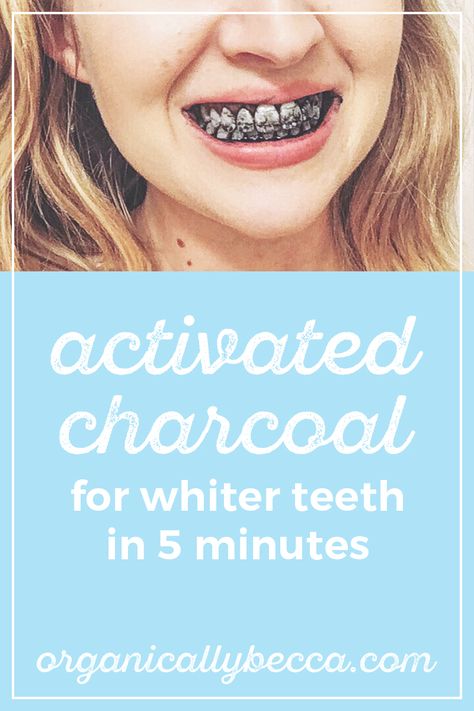 How to Use Activated Charcoal to Get Whiter Teeth in 5 Minutes White Teeth Overnight, Crunchi Makeup, Teeth Whiting At Home, Activated Charcoal Teeth Whitening, Get Whiter Teeth, Teeth Whitening Diy, Charcoal Teeth Whitening, Whiter Teeth, Stronger Teeth