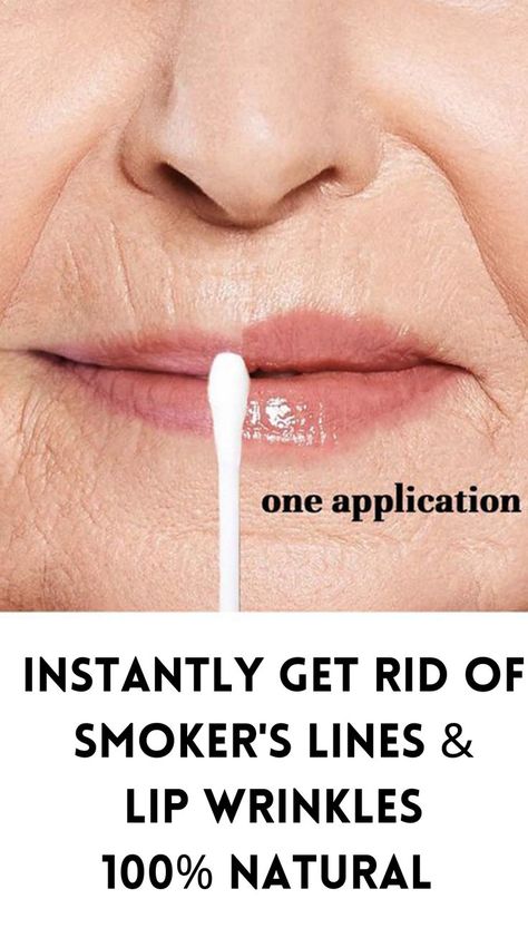 Wrinkles Skin Care, Smokers Lines, Plump Lips Naturally, Mouth Wrinkles, Makeup Tips For Older Women, Makeup For Older Women, Lip Wrinkles, Tighten Skin, Lip Filler