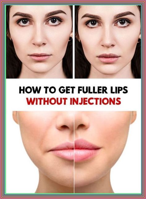 HOW TO GET FULLER AND BETTER LIPS WITHOUT SURGERY??? Get Bigger Lips, Bigger Lips Makeup, Bigger Lips, Fuller Lips Naturally, Healthy Book, Fuller Lips, Healthy Advice, Health Promotion, Lip Fillers