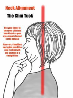 Upper Crossed Syndrome- A chiropractor's guide to postural pain Chin Tuck Exercise, Prehab Exercises, Punkty Spustowe, Neck Pain Exercises, Neck And Shoulder Exercises, Chin Tuck, Migraine Triggers, Natural Headache, Neck Muscles