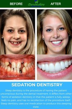 Permanent Dentures, Teeth Makeover, Healthy Grocery Lists, Fix Teeth, Dental Advertising, Mouth Care, Healthy Mouth, Tooth Care, Sedation Dentistry