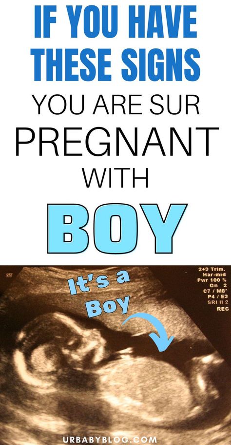 Are you wondering if you're having a girl or a boy? Your body does react different when you're pregnant with a girl vs a boy. Learn what the signs of a boy are. Signs Your Pregnant, Boy Vs Girl Pregnancy, Boy Or Girl Prediction, Signs You Are Pregnant, Pregnancy Gender Prediction, Phonics Reading Activities, Boy Or Girl Sign, Gender Chart, Baby Gender Prediction