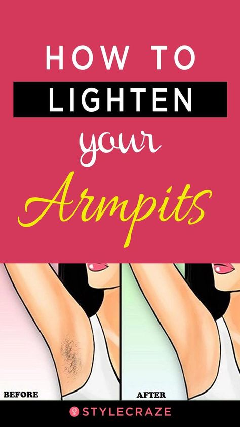 How To Lighten Your Armpits: what if we tell you that there are solutions that are homemade, simple, and absolutely natural to reduce dark armpits? Lighten your armpits with these easy-to-do-at home remedies that guarantee visible results. #skincare #skin Smelly Armpits, Daily Beauty Tips, Dark Armpits, Underarm Odor, Dark Underarms, Homemade Beauty Tips, Beauty Tips For Skin, Skin Remedies, I Love Makeup