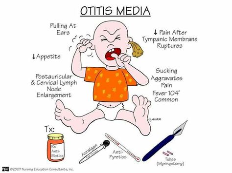 Otitis media Nursing Study Tips, Nursing Information, Nursing Mnemonics, Nurses Station, Nurse Midwife, Surgical Nursing, Medical Surgical Nursing, Nursing School Survival, Nursing School Studying