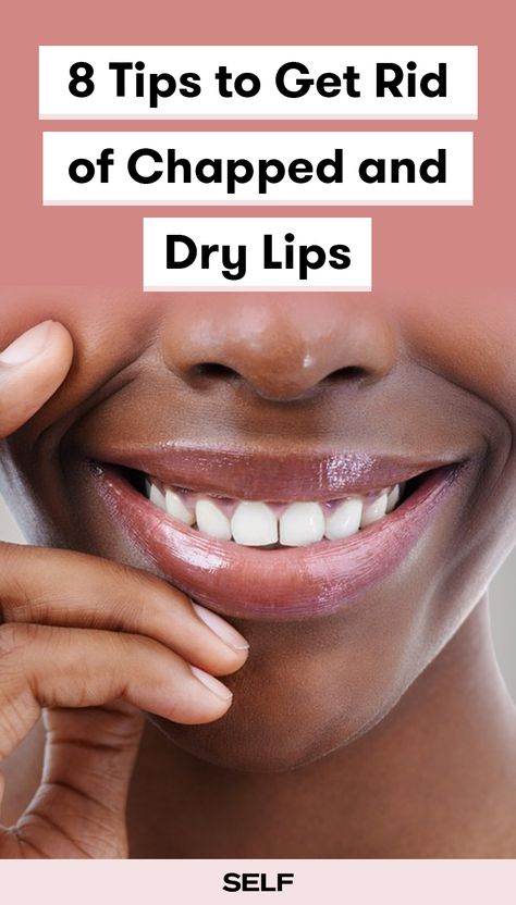 Looking for a severe chapped lips remedy as the weather gets colder? These simple products will help dry lips stay moisturized. Severely Chapped Lips Remedy, Peeling Lips Remedies, Chap Lips Remedy, Remedy For Dry Lips, How To Help Dry Lips, Dry Chapped Lips Remedy, Hydrated Lips Tips, Natural Lip Moisturizer, Severe Chapped Lips