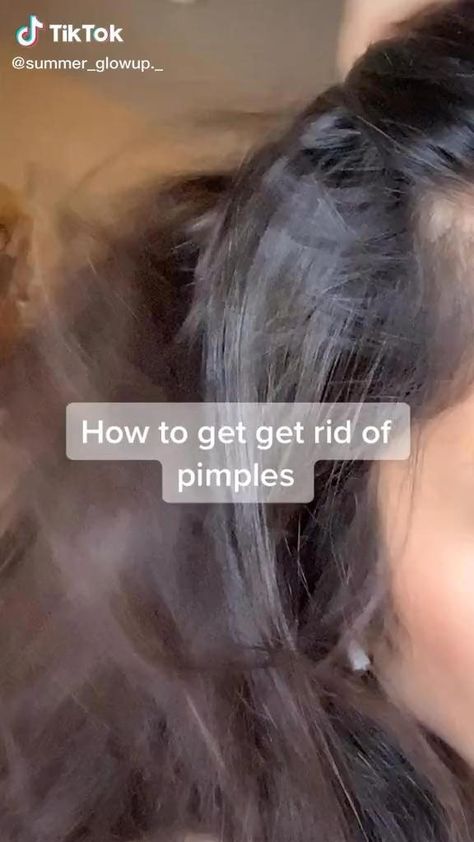 Haut Routine, Get Rid Of Pimples, Rid Of Pimples, Glow Ups, Good Skin Tips, How To Get Rid Of Pimples, Beauty Routine Tips, Get Rid Of Acne, Basic Skin Care Routine