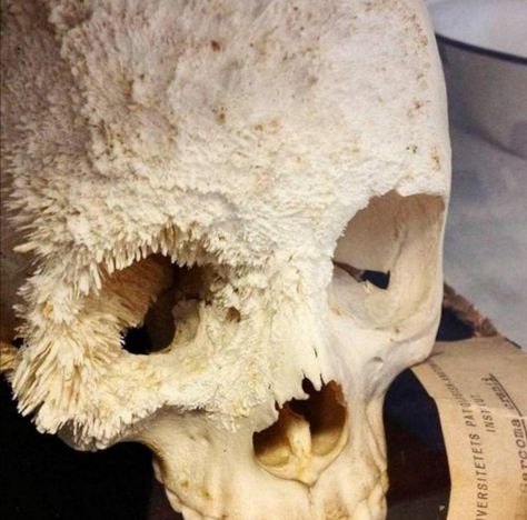 Taken from stashally user @junior. [Reddit, u/ tilltheend0ftime] Human Skull, Rich Kids, Yummy Smoothies, Skull And Bones, Art Plastique, Anatomy, Bones, Lion Sculpture, Art Inspiration