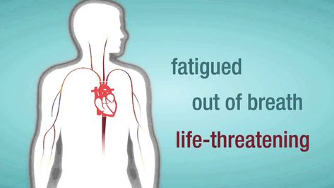 Heart Chambers, Mitral Valve Regurgitation, Nursing Informatics, Heart Valve, Tricuspid Valve, Heart Stuff, Mitral Valve, Lung Health, Heart Valves